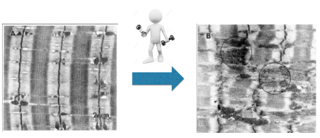 Le microlesioni